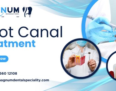 What is root canal treatment and when it is necessary
